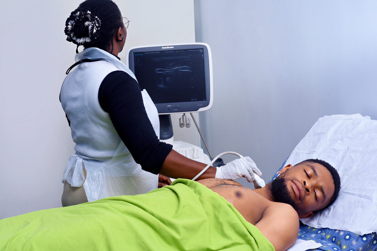 Patient receiving an echocardiogram (ECHO) scan