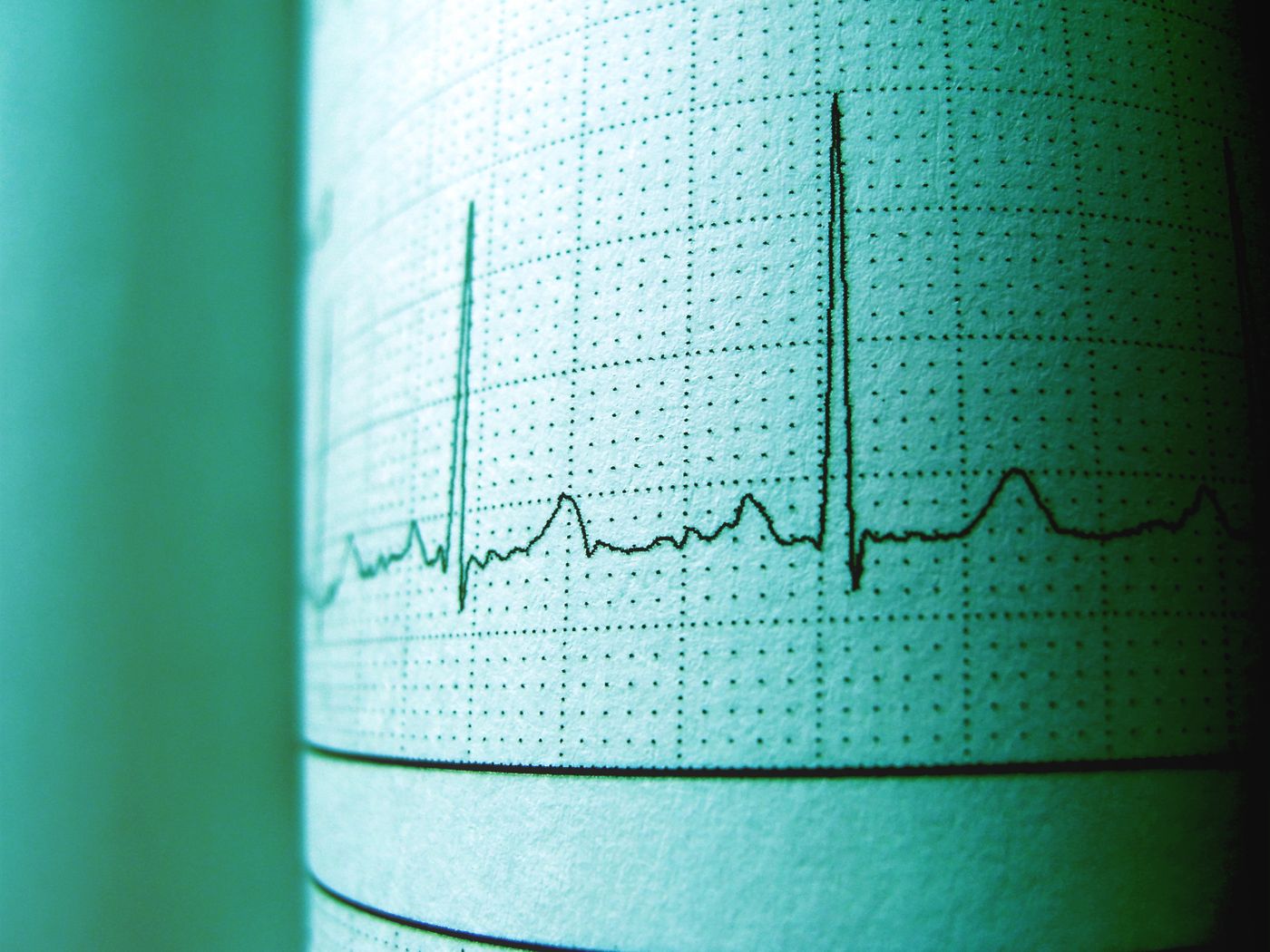 ECG rhythm strip showing heartbeats